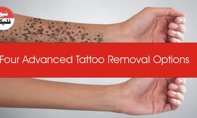 Four Advanced Tattoo Removal Options