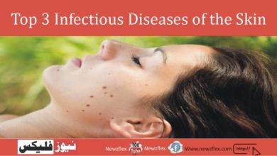 Top 3 Infectious Diseases of the Skin: