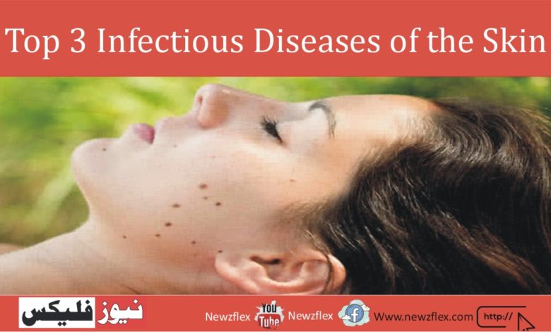 Top 3 Infectious Diseases of the Skin: