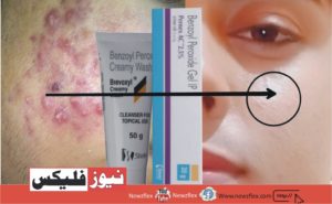 How to Get Rid of Pimples Overnight 10 Overnight DIY Remedies