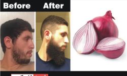 How To Increase Your Beard Growth Naturally at Home